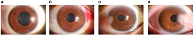 DBPF-net: dual-branch structural feature extraction reinforcement network for ocular surface disease image classification